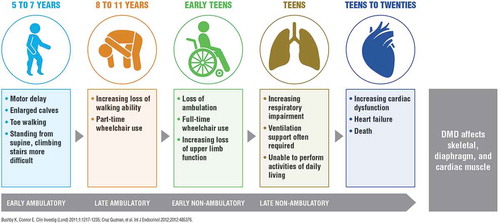 Figure 3. DMD disease progression.