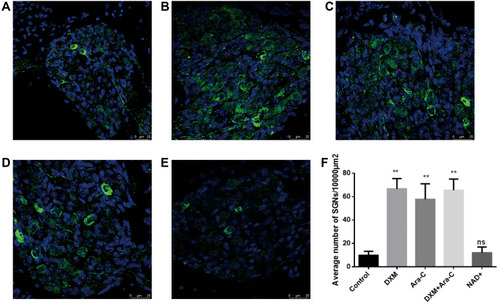 Figure 6 The effects of DXM, Ara-C and NAD+ on stria vascularis: (A) Positive control group (B) DXM group (C) Ara-C group (D) DXM+Ara-C group (E) NAD+ group. No significant difference was observed among groups. Stria vascularis are stained with phalloidin (red) and DAPI (blue).