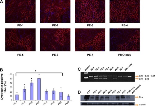 Figure 8 Restoration of dystrophin in tibialis anterior muscles of mdx mice (aged 4–5 weeks) 2 weeks after intramuscular injection.Notes: (A) Dystrophin was detected by immunohistochemistry with rabbit polyclonal antibody P7 against dystrophin. Blue nuclear staining with 4,6-diamidino-2-phenylindole. Muscles treated with PMOE23 (2 µg) only was used as controls. All other samples were from muscles treated with 2 µg polymer and 2 µg PMOE23 in 40 µL saline. Original magnification, 100×. (B) The percentage of dystrophin-positive fibers in muscles treated with 2 µg PMOE23 with and without polymers (2 µg). The maximum numbers of dystrophin-positive fibers were counted in a single cross-section (n=5, one-way analysis of variance test, #P≤0.05, there were significant difference between PE groups; Student’s t-test, *P≤0.05 compared with 2 µg PMO). (C) Detection of exon 23 skipping by reverse transcription-polymerase chain reaction. Total RNA of 100 ng from each sample was used for amplification of dystrophin mRNA from exon 20 to exon 26. The upper bands (indicated by E22 + E23 + E24) correspond to the normal mRNA, and the lower bands (indicated by E22 + E24) correspond to the mRNA with exon E23 skipped. (D) Western blots demonstrate the expression of dystrophin protein. Dystrophin detected with monoclonal antibody Dys 1. A loading control (α-actin) was used.Abbreviations: Dys, dystrophin; PE, polyelectrolyte; PMO, phosphorodiamidate morpholino oligomer.