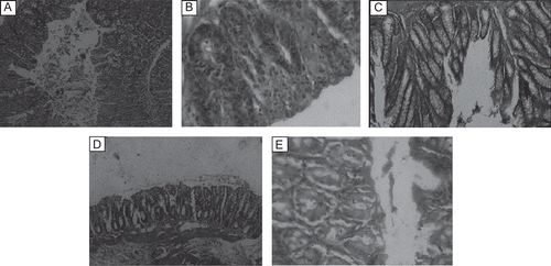 Figure 1.  Histopathological observations of colon tissue after the treatment with ethanol and aqueous extracts (100 mg/kg) of Vitex negundo roots. (A) Normal; (B) control (5% acetic acid); (C) standard; (D) ethanol extract; (E) aqueous extract.