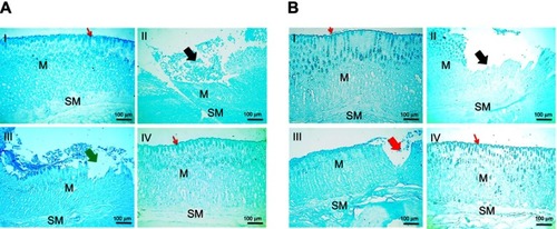 Figure 7 Histochemical staining of glandular stomach of rats with alcian blue stain following (A) concurrent induction and treatment regimen and (B) post-treatment regimen.Notes: (I) Normal control group, (II) positive control group, (III) free APO treated group, and (IV) APO-loaded COS-NPs (F4) treated group. Oral dose of free or loaded APO was 14 mg/kg. Thick black arrows point to loss of glycoproteins' secretion in mucosa near ulcer. Thick green arrow points to loss of glycoproteins' secretion in mucosa near erosion. Thick red arrow points to decreased glycoproteins' deposition in mucosa near erosion. Thin red arrows point to continued surface glycoproteins. Alcian blue stain, 100×.Abbreviations: APO, apocynin; COS, chitosan oligosaccharide; M, mucosa; NPs, nanoparticles; SM, submucosa.