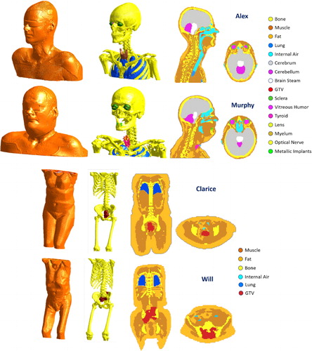 Figure 1. The Erasmus Virtual Patient Repository: Alex, Murphy, Clarice and Will CAD models.