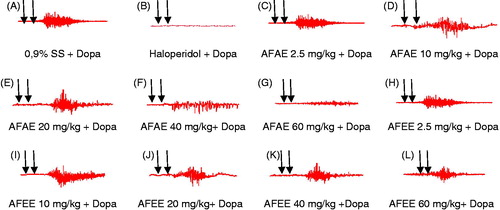Figure 2. Original EMG tracings showing the effects of intravenous injection of saline solution 0.9% (0.1 mL/kg) (A), haloperidol (0.01 mg/kg) (B), aqueous extract of A. floribunda (2.5, 10, 20, 40, 60 mg/kg) (C, D, E, F, G) and ethanol extract of A. floribunda (2.5, 10, 20, 40, 60 mg/kg) (H, I, J, K, L) followed 3 minutes later by the intravenous injection of dopamine (60 mg/kg) on the ejaculatory rhythmic motor pattern in sexually experienced spinal male rats. In each tracing the first arrow indicates the moment of injection of drugs and the second arrow indicates the moment of injection of dopamine. AFAE: A. floribunda aqueous extract, AFEE: A. floribunda ethanol extract, SS: Saline solution, Dopa: dopamine 60 mg/kg.