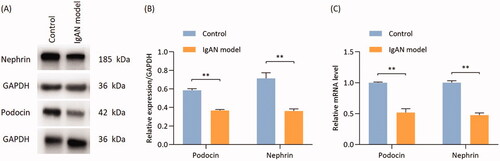 Figure 3. Proteins and mRNA expressions of podocin and nephrin are significantly reduced in IgAN mouse kidneys. (A) Western blotting results and (B) relative protein expression of nephrin and podocin. (C) Transcription levels of nephrin and podocin (n = 3). Data are expressed as mean ± SD. *p < 0.05, **p < 0.01 vs. control group. IgAN, IgA nephropathy.