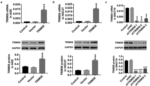 Figure 2. Overexpression and knockdown of TRIM58 in GC cells by lentiviral infection After lentiviral infection with vector or TRIM58 and shNC or shTRIM58 (shTRIM58-1, shTRIM58-2, and shTRIM58-3) (A-B) the overexpression efficiency of TRIM58 in AGS and HGC27 cells was detected. (C) The knockdown efficiency of shTRIM58-1, shTRIM58-2, and shTRIM58-3 in SNU719 cells was also detected. ***P < .001 was compared to vector or shNC.