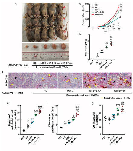 Figure 6. VEGF-enriched exosomes induce tumorigenesis and promote tumor vasculogenesis.(a–c). In vivo tumorigenesis of SMMC-7721 cells (1.0 × 107 in 500 μL Matrigel) inoculated with phosphate-buffered saline alone or with exosomes (12.5 μg/μl, a total of 100 μg) collected from HUVEC culture supernatant. Images of mice with tumors and harvested tumors after 21 days from SMMC-7721 cells implant (a). Red arrowheads indicate tumors. Tumor volume vs time (b) and tumor weight at 21 days after tumor cell implantation (c). Mean ± SEM, n = 4. *P < 0.05, **P < 0.01; ***P < 0.001 vs. PBS; #P < 0.05, ##P < 0.01 vs. miR-9; @P < 0.05 vs. miR-9 + 3-MA. (d). Endothelial vessels labeled with CD34 (yellow arrowhead) and VM vessels labeled with PAS (blue arrowhead). Data are representatives of three experiments with four animals per group. (e-g). Evaluation of number of endothelial vessels (e), and diameter (f). Area percentage of VM vessels (g). Mean ± SEM, six fields in 0.32 mm2 for each animal, four animals per group, n = 4. *P < 0.05, **P < 0.01; ***P < 0.001 vs. PBS; #P < 0.05, ##P < 0.01, ###P < 0.001 vs. miR-9; @@P < 0.01 vs. miR-9 + 3-MA.