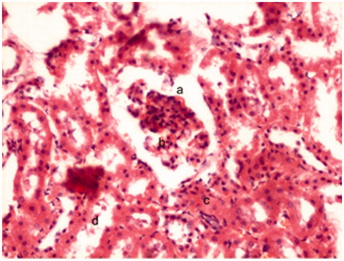 Figure 2. Photomicrograph of kidney sections of rats of experimental group treated with 4 mg MSG/g body weight for 30 d (PAS stain ×40). (a) Abnormal glomerulus, (b) hypercellularity, (c) degenerated renal tubule, (d) cellular debris.