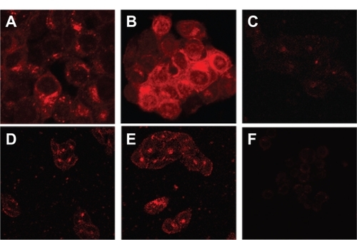 Figure 3 Uptake of different liposomes encapsulating mitoxantrone in various cell lines by confocal laser scanning fluorescence microscopy. Various cell lines were treated with either LHRH-MTX-SL or MTX-SL for four hours at 37°C. A LHRH-MTX-SL in LHRH receptor high-expressing MCF-7 cells; B MTX-SL in LHRH receptor high-expressing MCF-7 cells; C MCF-7 cells treated with drug-free medium used as a control; D LHRH-MTX-SL in LHRH receptor low-expressing SK-OV-3 cells; E MTX-SL in LHRH receptor low-expressing SK-OV-3 cells; F SK-OV-3 cells treated with drug-free medium used as a control.Abbreviations: LHRH, luteinizing hormone-releasing hormone; MTX, mitoxanthrone; SL, loaded liposomes.