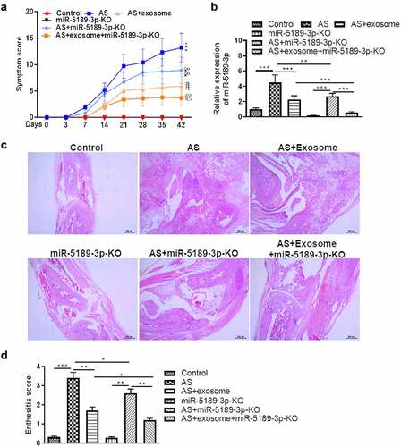 Figure 7. Effects of exosomes and miR-5189-3p in a mouse model of AS. (a) The arthritis scores were determined based on clinical arthritis severity of mice in each group. ***p < 0.001, AS group vs control group; ##p < 0.01, AS + exosome group vs AS group; &&p < 0.01, AS+miR-5189-3p-KO group vs AS group; @p < 0.05, AS + exosome + miR-5189-3p-KO vs AS + exosome group. (b) qRT-PCR analysis was used to detect the expression of miR-5189-3p in the ankle tissues of mice. (c) Representative H&E staining of ankle tissues are shown. (d) Analysis of histological scores for enthesitis was shown in bar graphs. *p < 0.05, **p < 0.01, ***p < 0.001.