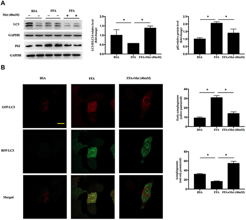 Figure 3 Metformin promotes autophagy in FFA-treated human keratinocyte. HaCat cells were treated with 400 μM FFA for 10 days, and then the intervention groups were co-treated with metformin (40mM) and FFA for additional 4 days. (A) Immunoblot of LC3 and P62 in HaCaT cells. (B) Representative confocal images of HaCat cells expressing GFP-RFP- LC3 and quantitation of early autophagosome puncta and autolysosome puncta following FFA and metformin treatment. Yellow showed co-localization of GFP and RFP, indicating early autophagosomes. Red only showed autolysosomes, scale: 20 μm. Data are presented as the mean ± SD and are representative of three independent experiments. *p < 0.05.