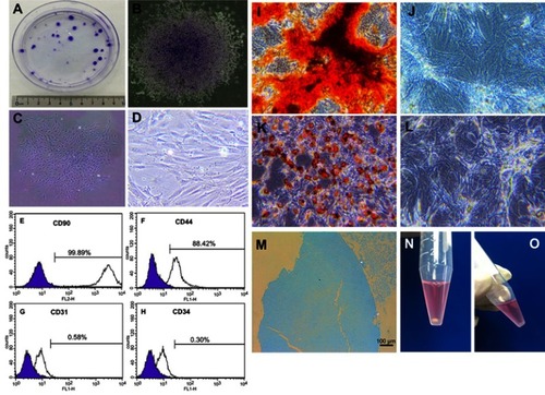 Figure 3 Identification of TSPCs in vitro. (A) General view of colony formation assay. (B) Microscopic observation of single colony colonies with crystal violet staining, magnification: x40. (C) Microscopic observation of P0 cells, magnification: x40. (D) Microscopic observation of P3 cells, magnification: x100. (E–H) Flow cytometry assay of stem cell surface specific markers. Alizarin red staining in the osteogenic induction group (I) and the control group (J), magnification: x100. Oil red O staining in the adipogenic induction group (K) and the control group (L), magnification: x100. Alcian blue staining of the cell pellet in the chondrogenic induction group (M), scale bars: 100 µm. General view of the cell pellet in the chondrogenic induction group (N) and the control group (O).Abbreviations: TSPCs, tendon stem/progenitor cells.