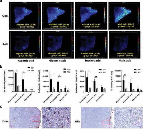 Figure 5. In situ visualization of crucial metabolites and metabolic enzymes in the glutamine metabolism pathway. a Representative MSI images of glutamine metabolism: spatial expressions of Glu, aspartic acid, succinate and malic acid in cancer tissue sections. b Glu, aspartic acid, succinate, and malic acid levels in the different cancer subregions (non-necrotic, para-necrotic, and necrotic tumor), between the control and the Akk gavaged mice. c IHC staining of the metabolic enzymes GLS in Lewis lung cancer tissue section, between the control and the Akk gavaged mice. Data are shown as mean ± SEM and were analyzed by ordinary one-way ANOVA. *P < .05; **P < .01.