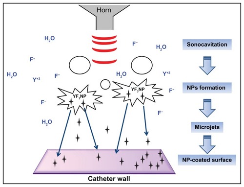 Figure 1 General view of the synthesis of YF3 NPs and NP deposition on a surface by sonochemistry.Notes: YF3 (black stars) is formed under ultrasonic irradiation (red waves). Microjets (blue arrows) are formed after the collapse of the acoustic bubble near the catheter wall and eject the NPs to create a YF3 NP coating.Abbreviations: NP, nanoparticle; YF3, yttrium fluoride.