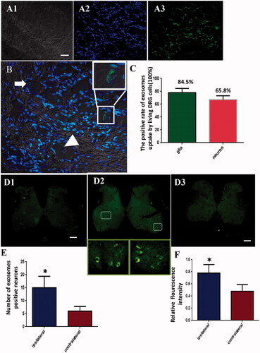 Figure 4. Exosome uptake by DRG cells and motor neurons of the anterior horn of the spinal cord at L5 and L6 segments in vivo. (A1) Open field photo of the DRG; (A2) DAPI staining of the DRG; and (A3) GFP-labeled DRG cells (green); Scale bar = 20 μm. (B) Merged image of A1, A2, and A3. Exosomes surrounding the nuclei of neurons are indicated with the arrowhead; exosomes inside the nuclei of neurons are indicated with the arrow. The bigger box is a zoomed-in image of the smaller box. (C) Profile showing the rate of exosome uptake by DRG glial cells and neurons in vivo. (D) Fluorescence micrographs showing GFP-positive neurons in the bilateral anterior horn of the spinal cord at the L5 and L6 segments on (D1) day 1 and (D2) day 5 after exosome injection. (D3) No GFP-positive neurons were observed in the PBS injection control group. Scale bar = 400 μm. (E) Profile showing the number and the (F) relative fluorescence intensity of neurons containing exosomes at the ipsilateral and contralateral sides of the anterior horn of the spinal cord on day 5 after exosome injection. n = 6. The asterisk indicates comparison with the opposite side，p < 0.01.