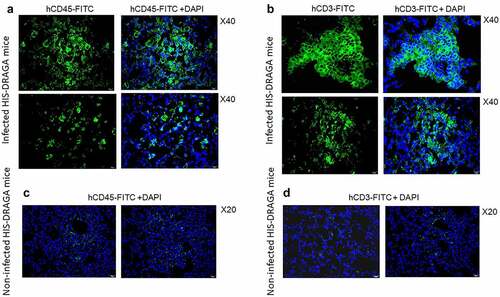 Figure 8. Infiltrating human lymphocytes in the lungs of SARS-CoV-2 infected HIS-DRAGA mice.