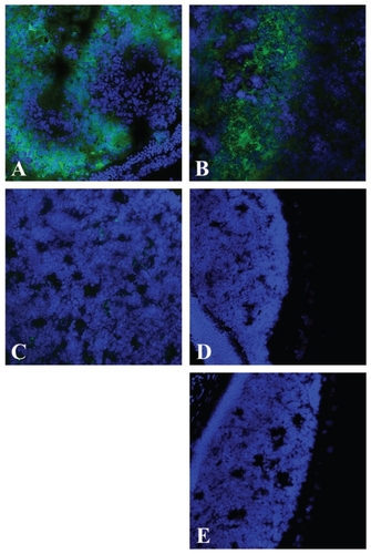 Figure 4 Post-treatment hypoxia in LHBETATAG retinal tumors. A) Saline treated, B) anecortave acetate (AA) treated, C) 2-deoxyglucose (2-DG) treated, D) 2-DG 1 day post-AA, and E) 2-DG 1 week post-AA. There is a significant decrease in the levels of hypoxia in eyes treated with 2-DG alone as well as combination treatment (AA +2-DG) compared with the saline controls (P < 0.001, for both). Representative composite images of pimonidazole (green)-stained and DAPI (blue, nuclear stain)- stained ocular sections of LHBETATAG mice treated with saline, AA, 2-DG, 2-DG 1 day post-AA injection, or 2-DG 1 week post-AA injection at ×200 magnification. Significant areas of hypoxia can be seen in the A) saline-treated group and the B) AA-treated group.