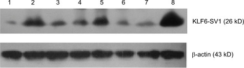 Figure 1 Western blot of tissue sections demonstrating KLF6-SV1.Notes: (1) The corresponding normal lung tissue specimen in one patent with pT2N0M0 (contrast). (2–8) Cancer specimen.Abbreviation: KLF6, Kruppel-like factor 6.