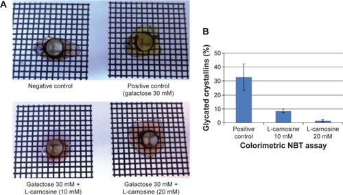Figure 8 Porcine lenses incubated in negative control medium, in high galactose medium, in high galactose with 10 mM L-carnosine, and high galactose with 20 mM L-carnosine (A); percentage glycated proteins (B).Abbreviation: NBT, nitro blue tetrazolium.