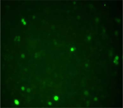 Figure 3 Morphology of K562/A02 cells after transfected for 48 hours under fluorescence microscope (400× SYBR® Green I staining).