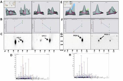 Figure S2 Increased levels of GPX-3 and PRDX-l in diabetic renal injury. (A and E) Magnification of GPX-3 protein spots (1271 and 1279) in GK+Sita (left) and GK rats (right) and PRDX-l protein spots (1246 and 1282) in GK+Sita (left) and GK rats (right). (B and F) Graphical presentation of GPX-3 and PRDX-1 expression in both conditions of all 2D-DIGE gels as analyzed using the DeCyder software. The blue line represents the median of all gels. (C and G) Validation of the changes in protein expression using 2D Western blot analysis. (D and H) Spots mass fingerprinting.