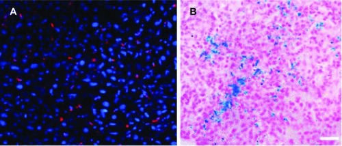 Figure 7 Histological studies of livers.Notes: (A) Fluorescent imaging and (B) Prussian blue staining of liver slices. Scale bar: 10 μm.