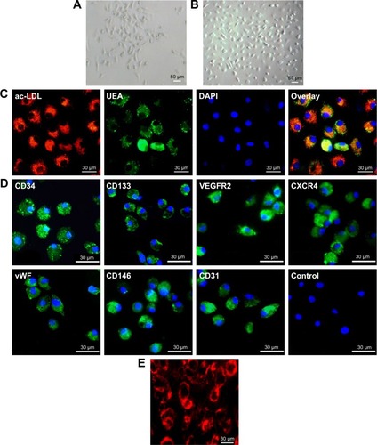 Figure 2 Morphological and immunocytochemical analyses of mouse bone marrow-derived EPCs. (A) The shape of mononuclear cells was thin and flat on day 3, and a round and fusiform appearance was subsequently observed on day 7 (magnification ×100). (B) On day 14, the cells exhibited a typical fusiform or “cobblestone” morphology (magnification ×100). (C) Uptake of Dil-labeled acLDL and binding of endothelial-specific fluorescein isothiocyanate-labeled lectin in EPCs in culture for 14 days (magnification ×400). Lectin and lipoprotein positivity colocalized in >95% of cells. (D) Immunocytochemical images of cells showing positive staining for the CD34, CD133, VEGF receptor 2, CXCR4, vWF, CD146 and CD31 markers. (E) Fluorescence image showing the uptake of multimodal imaging of bCD-PLL by EPCs (day 14) with positive rhodamine signals (magnification ×400).Abbreviations: EPC, endothelial progenitor cell; acLDL, acetylated low-density lipoprotein; VEGF, vascular endothelial growth factor; CXCR4, C-X-C chemokine receptor 4; vWF, von Willebrand factor; bCD, bacterial cytosine deaminase; PLL, poly-L-lysine; UEA, Ulex europaeus agglutinin-1; DAPI, 4′,6-diamidino-2-phenylindole; VEGFR2, VEGF receptor 2.