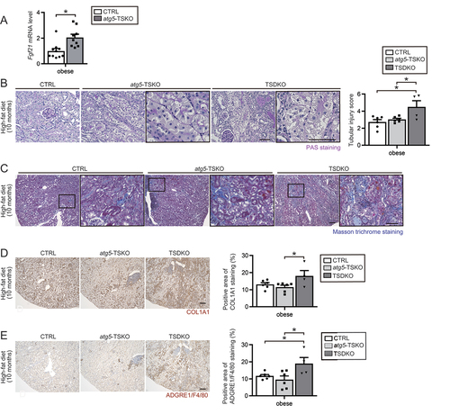 Figure 6. FGF21 deficiency aggeravates high-fat diet-induced kidney injury in autophagy-deficient mice. (A) mRNA expression levels of Fgf21 using whole kidney lysates of obese CTRL and atg5F/F-TSKO mice under a high-fat diet for 2 months (n = 9 to 10). (B, C, D and E) Representative images of PAS staining (B), Masson trichrome staining (C), immunostaining for COL1A1 (D), and ADGRE1/F4/80 (E) in the kidney cortical regions of obese CTRL, atg5F/F-TSKO, and TSDKO mice (n = 4 to 6) under a high-fat diet for 10 months. The tubular injury score (B right), COL1A1-positive area (D right), and ADGRE1/F4/80-positive area (E right) were quantified in at least 10 high-power fields (×400), respectively. Kidney sections were counterstained with hematoxylin. Bars: 50 m. Data are provided as means ± SE. Statistically significant differences (*P < 0.05) are indicated.