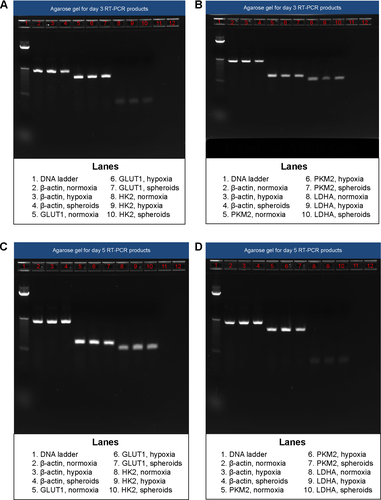 Figure S2 RT-PCR analysis of glycolytic markers in two-dimensional SKOV-3 ovarian cancer cell culture and in three-dimensional spheroids.Notes: The bands run on the 2% agarose E-gel image show relative expression of (A) GLUT I and HK2 for day 3 samples, (B) PKM2 and LDHA for day 3 samples, (C) GLUT I and HK2 for day 5 samples, and (D) PKM2 and LDHA for day 5 samples. Lanes 11 and 12 in both the gels are blank lanes run with deionized water.Abbreviations: GLUT1, glucose transporter 1; HK2, hexokinase-2; LDHA, lactate dehydrogenase A; PKM2, pyruvate kinase isoform M2; RT-PCR, reverse transcription polymerase chain reaction.