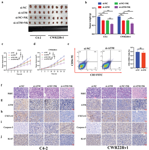 Figure 9. NK cell recruitment inhibited ATM expression and CRPC proliferation in vivo. a. photograph of CRPC cell lines induced transplantation tumors (with or without) NK cell injection. b-d. the volume and weight of the transplantation tumors. e. fluorescence-activated cell sorting (FACS) study of CD56+CD3- NK cells in xenograft tumors with either si-NC or si-ATM group. f. The visualization of transplantation tumor tissues was evaluated by H&E staining. g-j. The expression of ATM, CXCL12, caspase-3, and ki-67 in transplantation tumor tissues was assessed by immunohistochemical analysis. Scale bar = 20 μm. Data are presented as the mean ± SD; n =5; **P < .01. Data were analyzed by using two-way ANOVA with Tukey’s multiple comparisons.