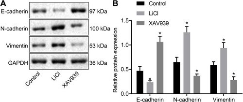 Figure 7 Suppressed Wnt/β-catenin signaling pathway inhibited EMT in PC. (A) protein bands of E-cadherin, N-cadherin, Vimentin in each group by Western blot analysis; (B) protein levels of E-cadherin, N-cadherin, Vimentin in each group as normalized to GAPDH. *p < 0.05 vs cells without treatment.