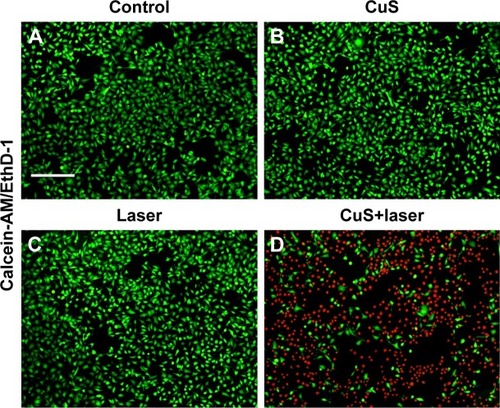 Figure 4 Fluorescence images of HeLa cells.Notes: (A) The cells were incubated with nothing. (B) The cells were incubated with PEG-DA-CuS NPs (200 μg/mL) alone. (C) The cells were exposed to laser irradiation (1 W/cm2, 1,064 nm laser, 10 minutes) alone. (D) The cells were incubated with PEG-DA-CuS NPs (200 μg/mL) and exposed to laser irradiation (1 W/cm2, 1,064 nm laser, 10 minutes). Calcein-AM (green fluorescence representing live cells) and EthD-1 (red fluorescence representing dead cells) were used as indicators. The scale bar is 50 μm. Magnification is 10×.Abbreviations: AM, acetoxymethyl; EthD-1, ethidium homodimer-1; NPs, nanoparticles; PEG, polyethylene glycol.