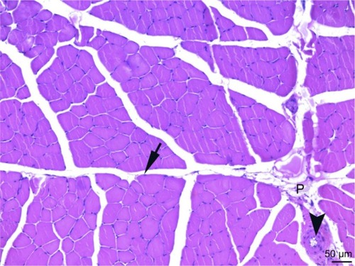 Figure 6 The cross-sectional faces of striated skeletal muscle fibers are observed in a multi-sided appearance in the micrograph of the picroside group. Peripheral nuclei (arrow) under the sarcolemma of muscle fibers and blood vessels (arrowheads) in the perimysium (P) surrounding the fascicles formed by muscle fibers are observed. H&E ×200.