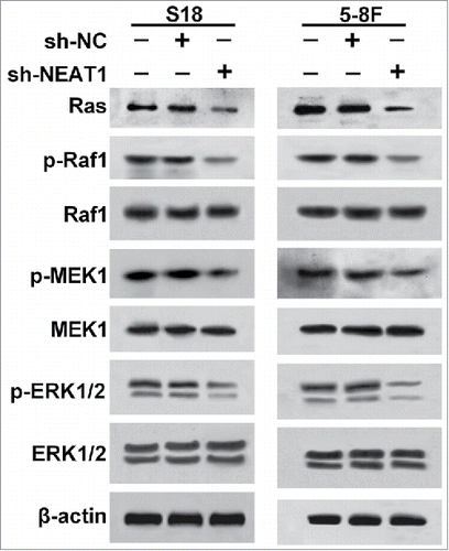 Figure 6. Knockdown of NEAT1 inhibited the Ras-MAPK pathway. Western blot analysis was conducted to measure protein levels of Ras, p-Raf1, Raf1, p-MEK1, MEK1, p-ERK1/2 and ERK1/2 in S18 (A) and 5–8F (B) cells transfected with sh-NEAT1 or sh-NC.