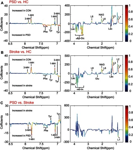 Figure 4 Identification of differential metabolites responsible for discrimination among PSD, stroke and healthy comparison groups. (A and B) The loading coefficient plots of the OPLS-DA models show metabolite variations attributable to distinguishing the PSD group from the stroke and healthy comparison groups; (C) The plasma metabolites responsible for discrimination between stroke and healthy comparison subjects.Abbreviations: HC, healthy comparison; OPLS-DA, orthogonal partial least-squares discriminant analysis; PSD, post-stroke depression.