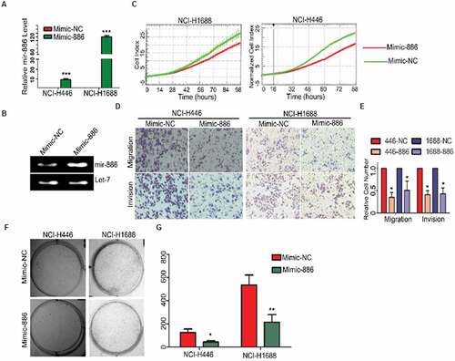 Figure 1. In vitro suppression of SCLC cell proliferation, migration and invasion by exogenous miR-886-3P.