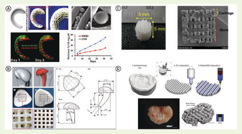 Figure 4. Polycaprolactone printing.Printing of anatomically accurate (A) meniscus embedded with PLGA beads that spatially released either TGF or CTGF to the inner and outer regions, respectively [Citation66]. Reprinted with permission from AAAS and (B) a humeral head fabricated to facilitate cellular homing, which was implanted into a rabbit model [Citation182]. Reprinted from The Lancet © 2010, with permission from Elsevier. (C) A reinforced osteochondral plug with spatially distributed bioinks of HA and atelocollagen for cartilage and bone regeneration [Citation143] © IOP Publishing. Reproduced with permission. All rights reserved. (D) composite reinforced alginate bioink for endochondral tissue engineering printed in the shape of vertebrae, which supported mineral deposition and vasculature [Citation13]. Reproduced with permission from John Wiley & Sons Inc.HA: Hyaluronic acid; PLGA: Poly(lactic-co-glycolic acid).