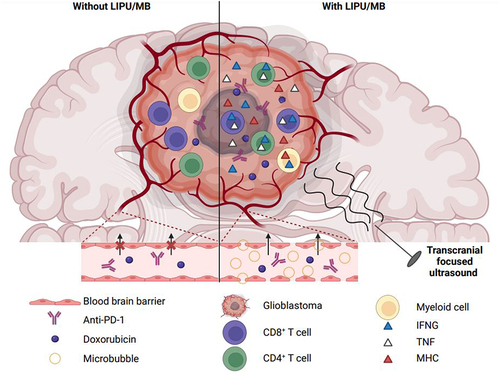 Figure 1. Ultrasounds combined with administration of microbubbles facilitate the delivery of doxorubicin/anti-PD-1 to glioblastoma and improve therapeutic efficacy. LIPU/MB transiently opens the blood-brain barrier, facilitating the access of liposomal doxorubicin and anti-PD-1 to glioblastoma. Locally, concentration of the dual therapeutic agents stimulates IFNG production by cerebral myeloid cells and upregulation of MHC molecules by surrounding cells like malignant cells. This pro-inflammatory environment enhances the recognition of cancer cells by T lymphocytes. These latter show polyfunctionality, secreting both IFNG and TNF, improved antitumor activity, and persist in treated mice surviving the disease. IFNG, interferon-gamma; LIPU, low-intensity pulsed ultrasound; MB, microbubble; MHC, major histocompatibility complex; PD-1, programmed cell death 1; TNF, tumor-necrosis factor-alpha.