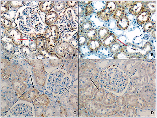 Figure 3. Prevalent and strong smearing with iNOS antibodies were observed at exercise (A), exercise–HPD (B) groups (red arrow). At control group (C) and HPD (D) groups, focal, weak, or moderate smear was observed (200×).