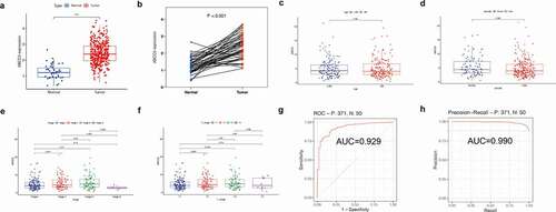 Figure 4. Clinical value of ABCC5 expression in HCC. (a)Without matching between HCC and normal tissues, ABCC5 gene expression in HCC was up-regulated (P < 0.05). (b)The expression of ABCC5 gene in HCC was up-regulated (P < 0.05) after random matching between HCC and normal tissues. (c)The expression of ABCC5 was not related to age, and there was no significant difference in the expression of this gene between HCC patients>60 years old and HCC patients≤60 years old. (d)There was no significant difference in the expression of ABCC5 between male and female HCC patients. (e)There was a significant difference between stage 1 and stage 3 of ABCC5 (P < 0.05), and the expression level of ABCC5 in stage 3 was higher than that in stage 1. (f)The expression of this gene was different between T1 and T3 (P < 0.05), and the ABCC5 expression level of T3 was higher than that of T1. (g, h)We evaluated the diagnostic value of ABCC5 in HCC by plotting the ROC curve (Figure 4(g)) and PRC curve (Figure 4(h)). It was found that the AUC value of ROC curve was 0.929, and the AUC under the PRC curve was 0.990, suggesting that this gene could be a good potential diagnostic marker for HCC