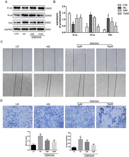Figure 3. GSK343 mitigated high glucose-induced EMT and migration capacity. (A) The expression of E-cadherin, N-cadherin and vimentin was significantly reversed by GSK343 compared with that in the HG group when HPMCs were treated with high glucose in the presence or absence of GSK343. (B) Quantitative analysis of the data shown in A. (C) A wound-healing assay showed that GSK343 could inhibit the migration capacity induced by HG. (D) Transwell assays revealed that the high glucose-induced high migration capacity was relieved by GSK343. Statistical analysis of the results shown in Panels C and D was conducted (Data are the mean ± SD; *p < .05 vs. CTR group, #p < .05 vs. high glucose (HG) group, n = 3).