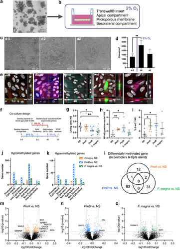 Figure 3. P. micra impact on human colonic primary epithelial cells.