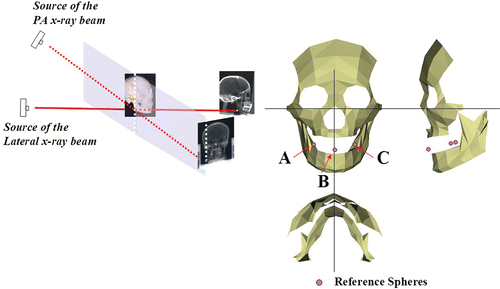 Figure 2. Coordinate system in 3D cephalometric modeling. The reference spheres (A, B and C) are recognized on the lateral and PA cephalometric images and their 3D coordinates are computed. [Color version available online.]