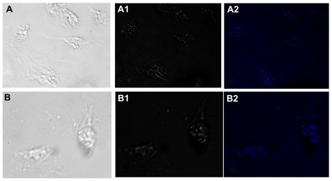 Figure 8 Fluorescence micrographs showing interaction of macrophages incubated with gold nanoparticles conjugated with liver cell surface-specific antibodies. Upper and lower panels show the micrographs captured after 2 and 4 hours of incubation, respectively, in bright field, phase contrast and DAPI filter. Punctate fluorescence is observed due to endocytosis mediated-uptake of gold nanoparticles by macrophages.