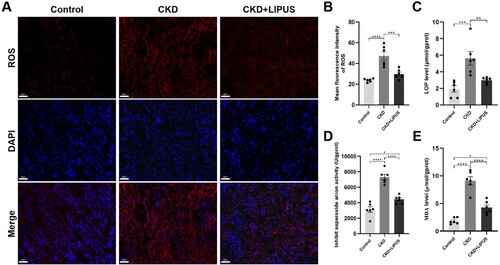 Figure 6. Treatment with LIPUS inhibited ferroptosis-related oxidative stress in the ADR-induced CKD rat. (A) Representative micrographs of reactive oxygen species (ROS) staining in each group. Scale bar, 50 μm. (B) The absolute expression level of ROS was quantified as the average fluorescence intensity. The levels of lipid peroxide (LPO) (C), superoxide anionic (O2-) (D) and malondialdehyde (MDA) (E) in rat kidney tissue were assayed by enzyme linked immunosorbent assay (ELISA). Data represent the mean ± standard error of the mean (SEM) for 6 rats in each group. *p < 0.05, ** p < 0.01, ***p < 0.001, **** p < 0.0001.