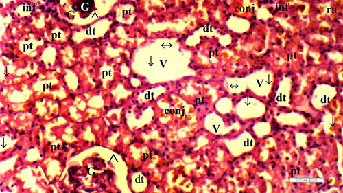 Figure 7 Representative light microscopy of kidney tissue from ischemia/reperfusion group.