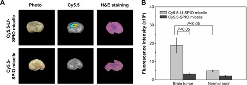Figure 7 Ex vivo study of the brain tissue.Notes: (A) Ex vivo fluorescence images and H&E-staining images of rat brain bearing C6 glioma at 48 hours postinjection. (B) The average fluorescence intensity of the brain tumor and the normal brain. Results expressed as means ± standard error of mean (n=6).Abbreviations: Lf, lactoferrin; SPIO, superparamagnetic iron oxide; H&E, hematoxylin and eosin.