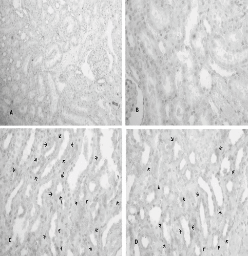 Figure 4. (A) No expression of Shh in sham-control group (Immuno-Peroxidase,  × 200), and (B) Shh-positive immunostaining mildly detected in the group 2 animals (Immuno-Peroxidase,  × 200). In contrast, (C) Shh expression by intensity in the tubulus epithelia from I-R/ L-Arg group rats (arrows) (Immuno-Peroxidase,  × 200).