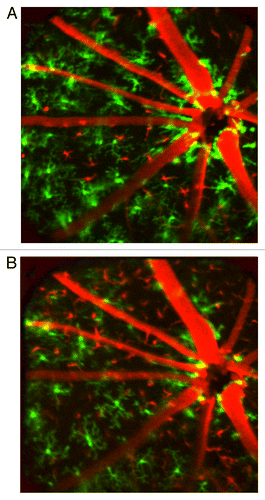 Figure 5. Images taken (A) 42 and (B) 60 d after irradiation and bone marrow transplantation demonstrate that engraftment of bone marrow derived cells first occurs near the optic nerve head. Engrafting cells display both ramified and dendriform morphology.