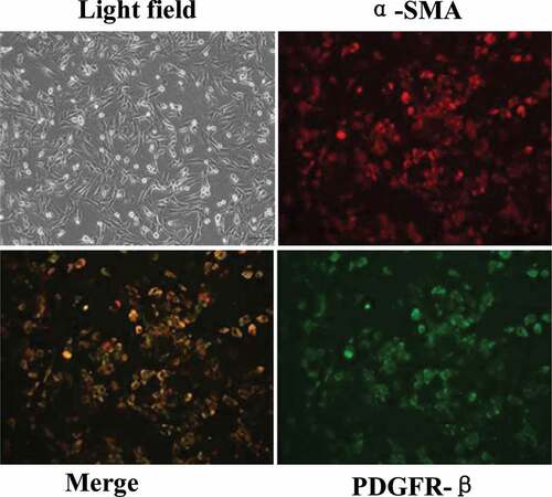 Figure 2. Primary BMPs identified by immunofluorescence co-staining of α-SMA and PDGFR-β