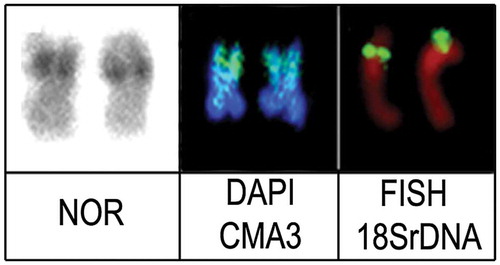 Figure 3. The first metacentric chromosome pair of Crenicichla lepidota from Quadros Lagoon, highlighting the markers NOR, DAPI/CMA3, and FISH with 18S rDNA probe.